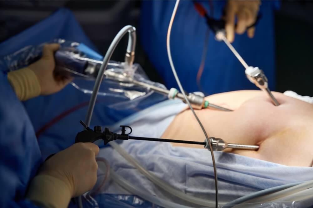 Robotic uterus removal surgery in Mohali