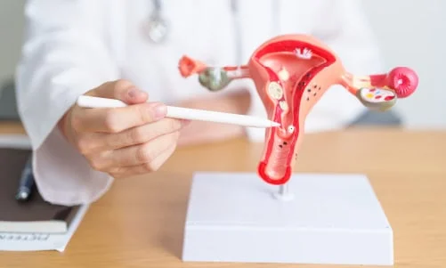 uterus removal expert in Mohali